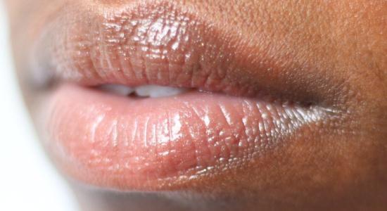 Best dermal fillers in 2023